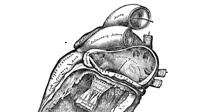Hammersmith Echocardiology Conference 2013