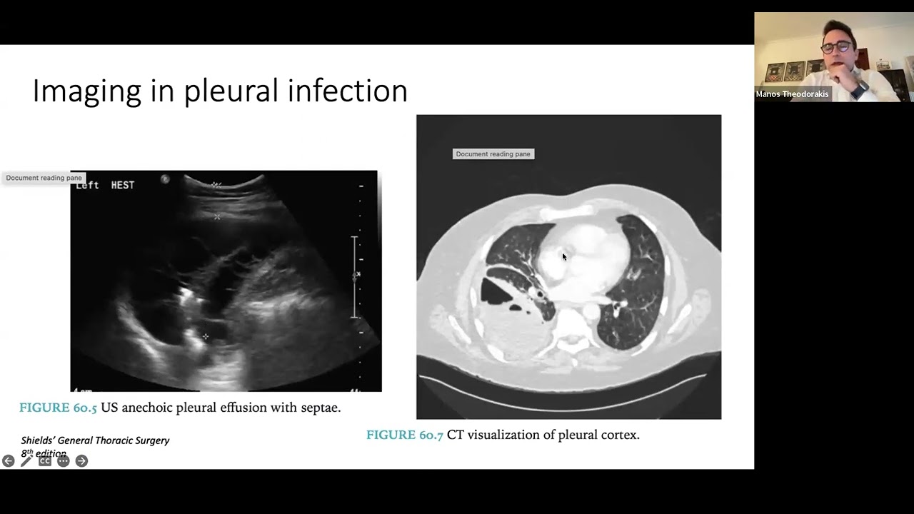 16o μάθημα Ακαδημίας Χειρουργικής Θώρακος- Καρδιάς