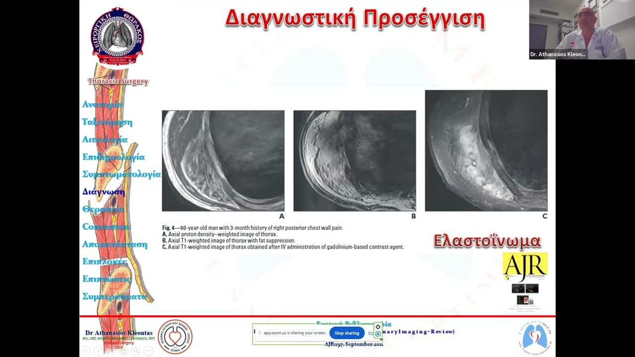 23ο μάθημα Ακαδημίας Χειρουργικής Θώρακος- Καρδιάς