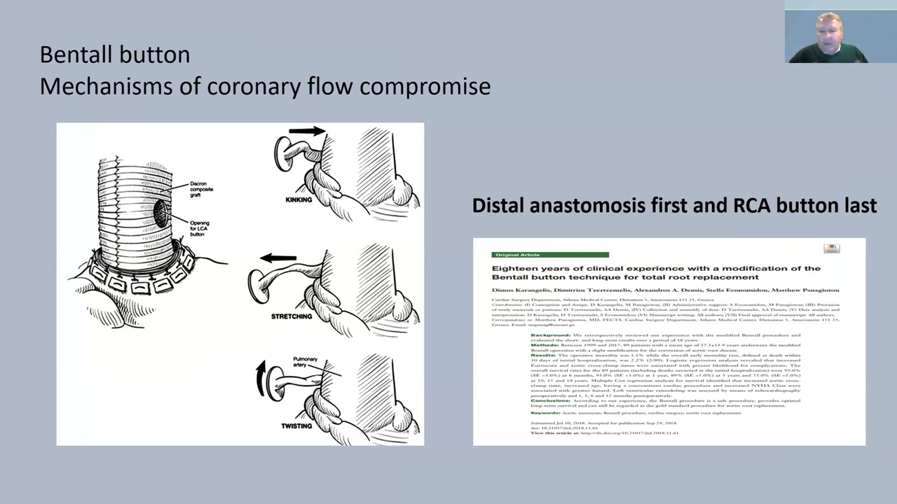 26ο μάθημα Ακαδημίας Χειρουργικής Θώρακος- Καρδιάς
