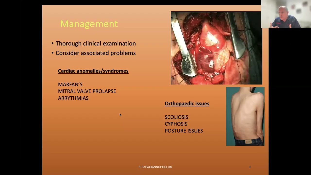29ο Μάθημα της Ακαδημίας Χειρουργικής Θώρακος - Κραδιας