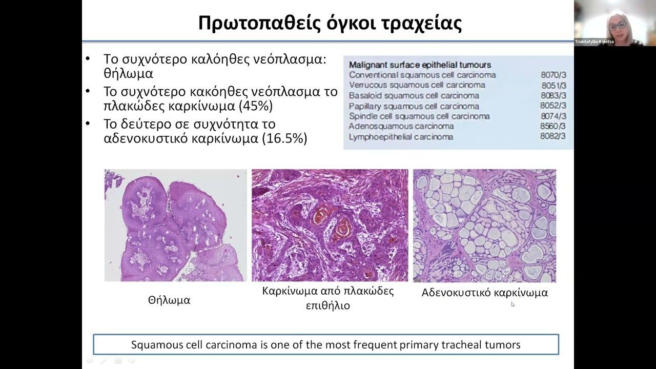 39o Μάθημα της Ακαδημίας Χειρουργικής Θώρακος-Καρδιάς