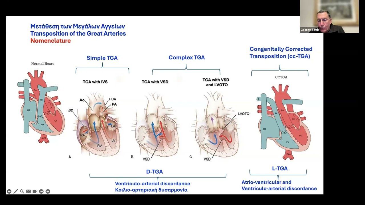 43o Μάθημα της Ακαδημίας Χειρουργικής Θώρακος-Καρδιάς