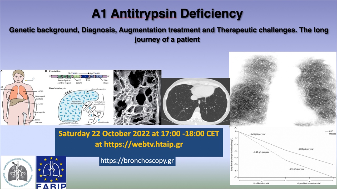 A1 AT DEFICIENCY: THE LONG JOURNEY OF A PATIENT