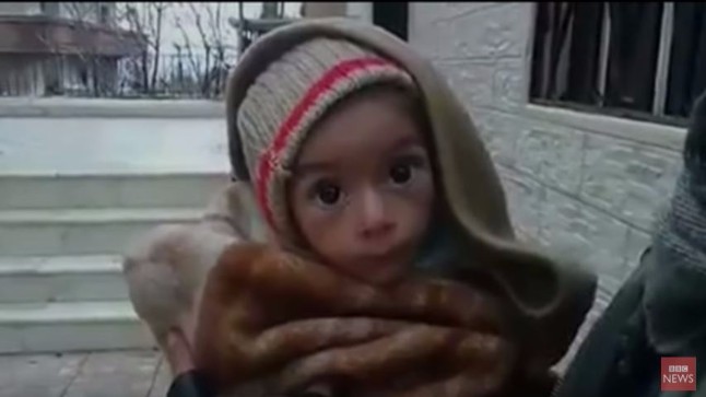 Φρίκη από τα αποστεωμένα παιδάκια στη Συρία