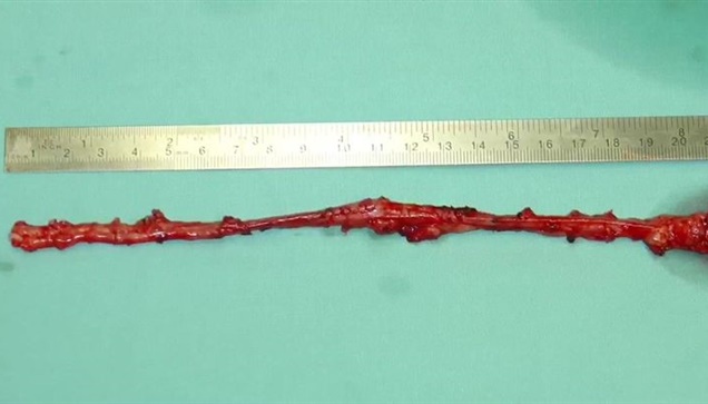 Ρωτάμε τους ειδικούς: Ο Καρδιοθωρακοχειρουργός Δρ. Κοσμάς Τσακιρίδης και οι συνε...