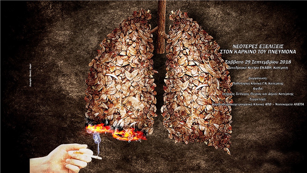 Νεότερες εξελίξεις στον καρκίνο του πνεύμονα