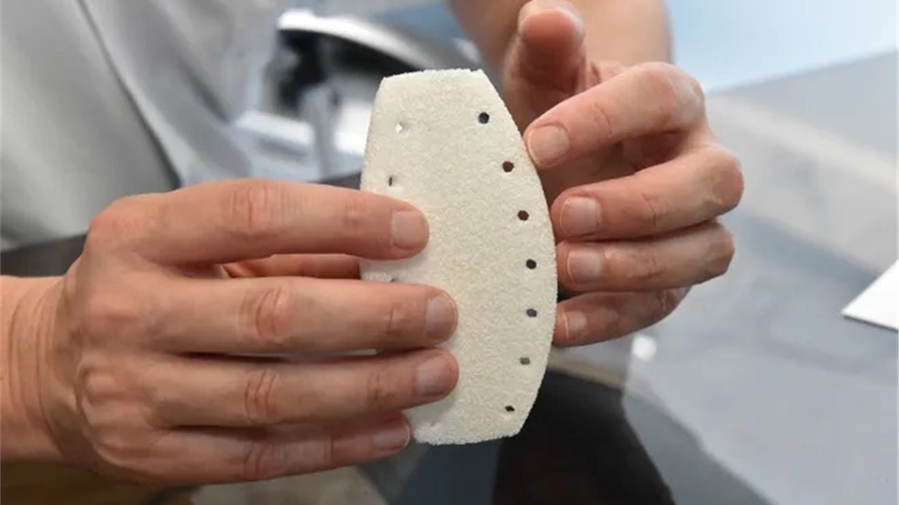 Πρώτη επέμβαση στην Ελλάδα μερικής αντικατάστασης στέρνου, με...