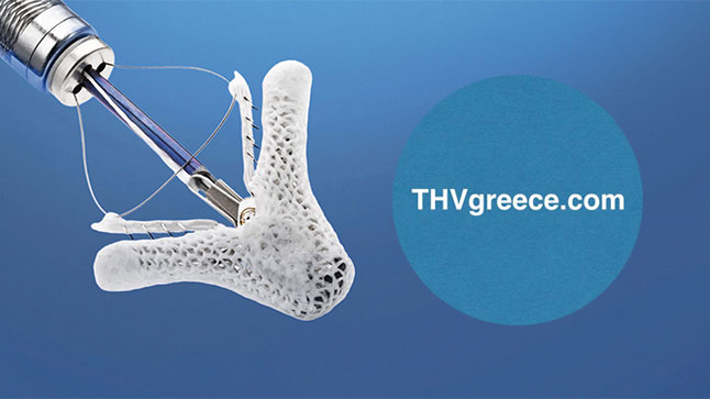 ΔΙΑΚΑΘΕΤΗΡΙΑΚΗ ΘΕΡΑΠΕΙΑ ΚΑΡΔΙΑΚΩΝ ΒΑΛΒΙΔΟΠΑΘΕΙΩΝ